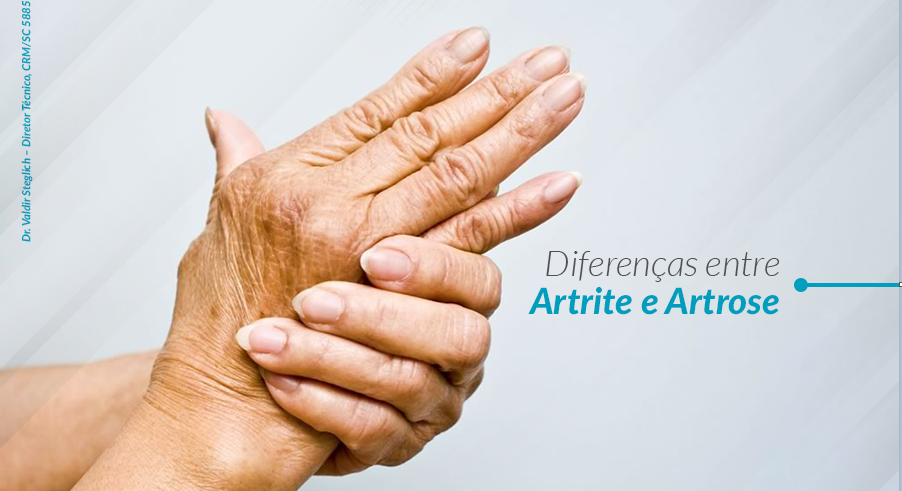 artrite si artroze